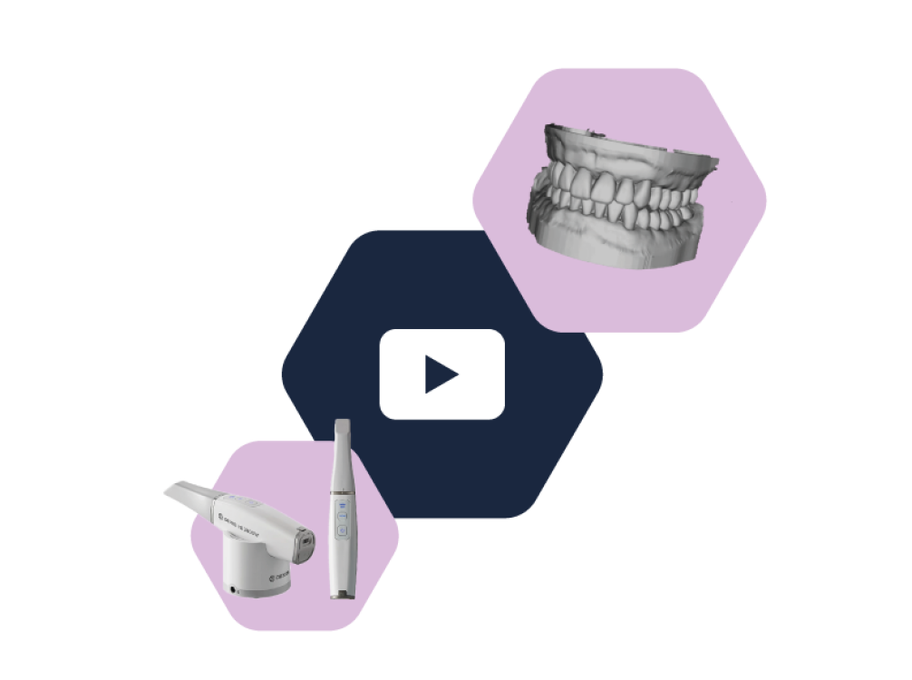 VIDEO - Tvorba 3D modelu chrupu