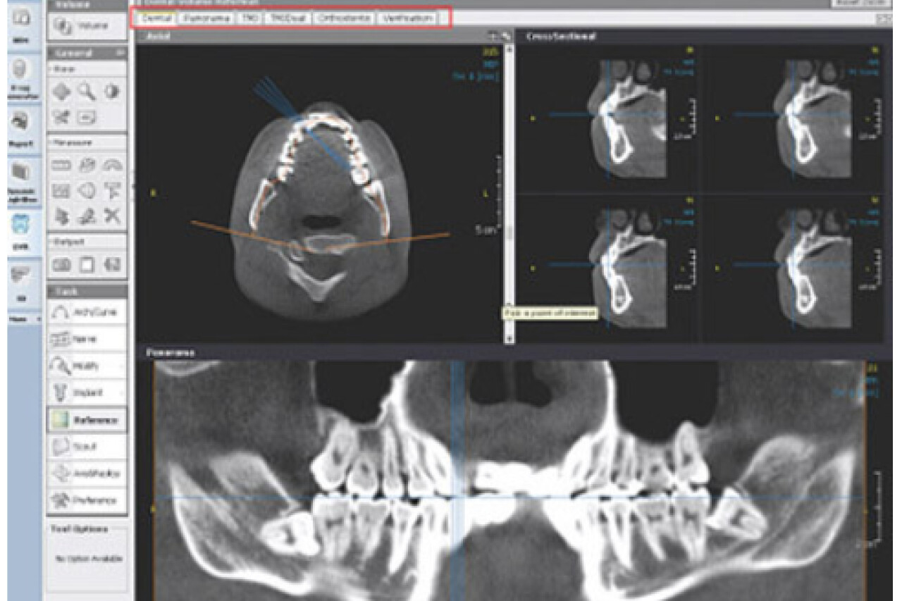 Dental modul