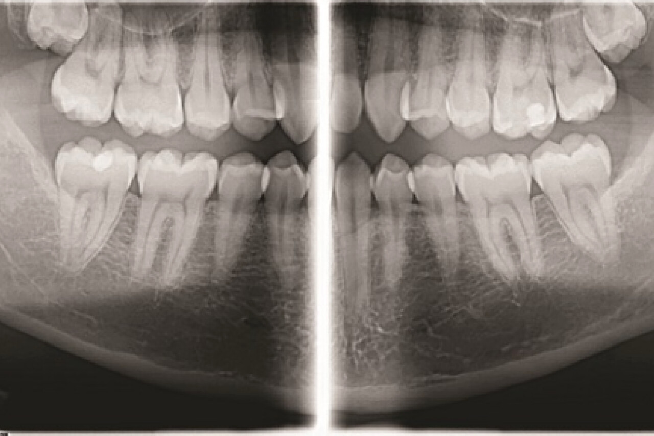 Program Ortho Zone
