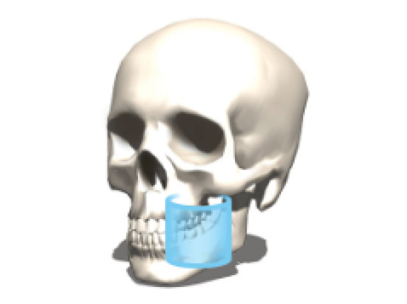 5 x Ø 5 cm (6 x Ø 4 cm)