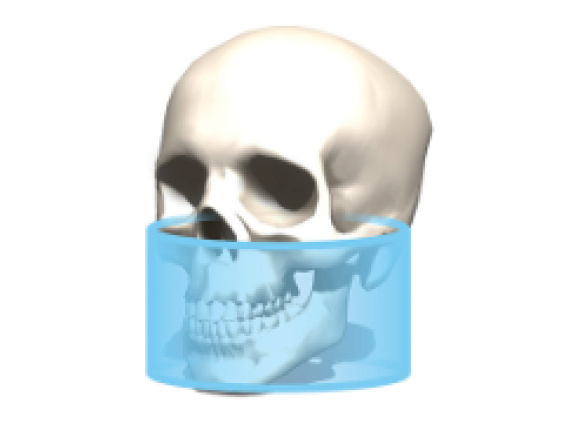 8 x Ø 15 cm