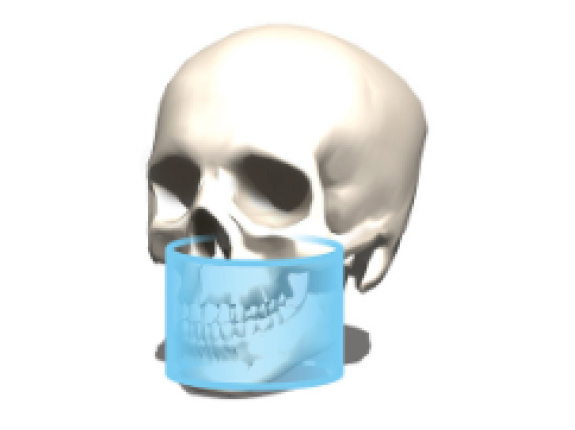 8 x Ø 8 cm