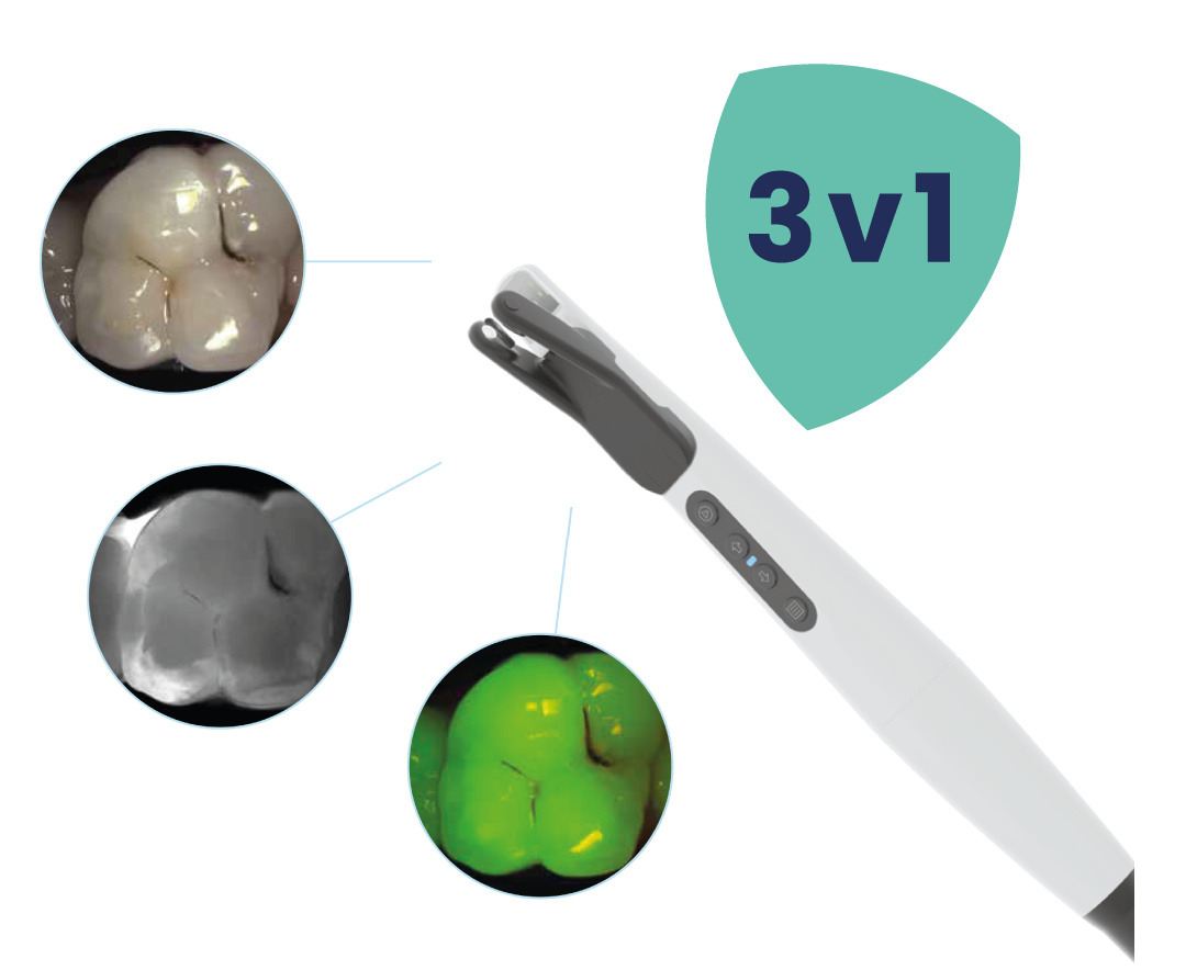DIAGNOcam Vision Full HD - Tři klinicky relevantní snímky jedním klikem