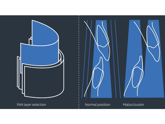 Homogenní snímky s technologií V-Shape-Beam