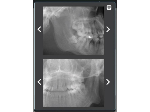 SMARTVIEW™