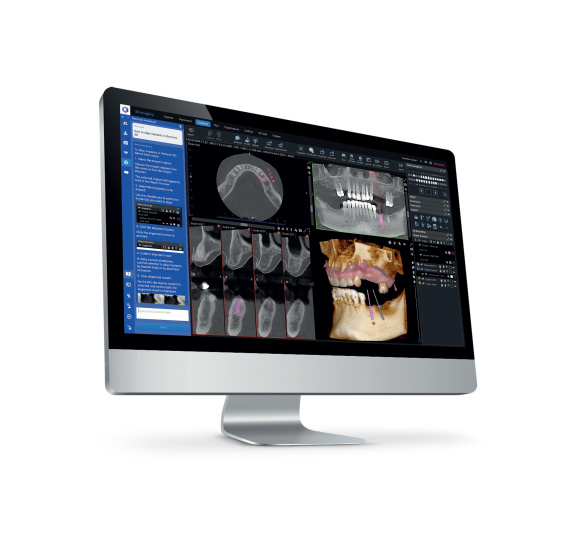 Software Romexis 7 - Flexibilní a všestranné řešení pro Vaši praxi