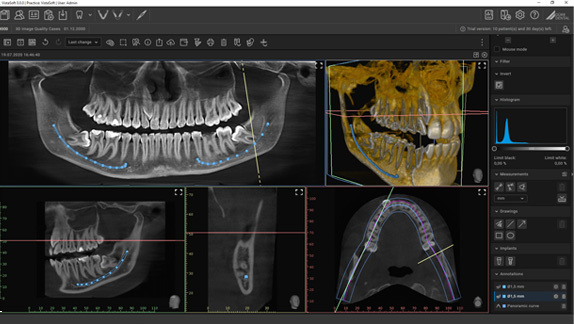 Vista Soft 3D