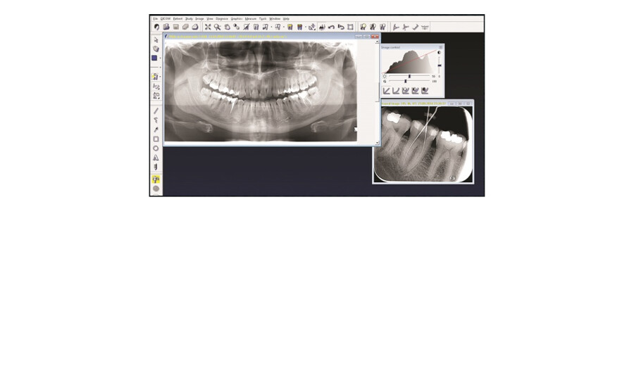 Rentgenový software CliniView