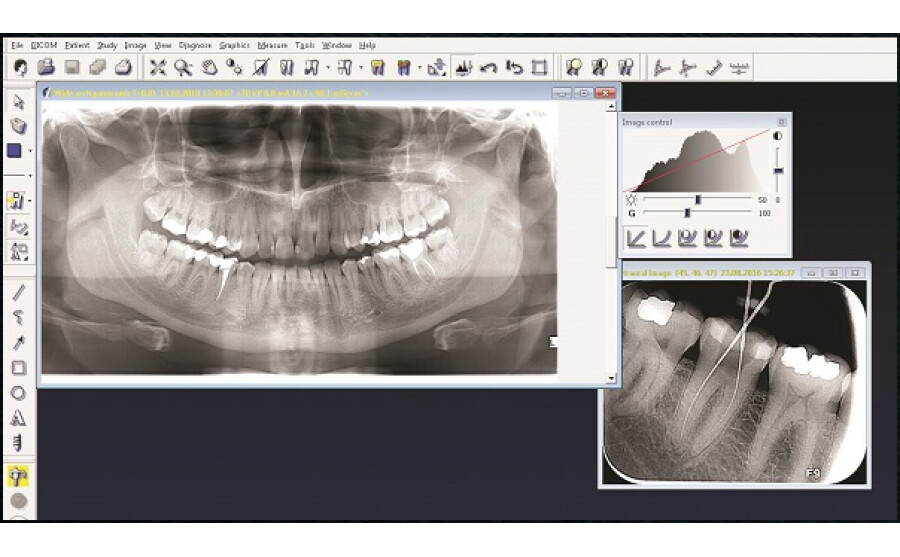 Rentgenový software CliniView