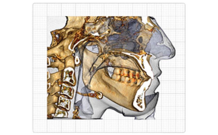 Zobrazovací lékařský software Invivo 6