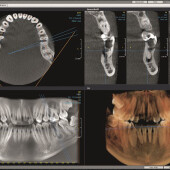 Rentgenový software CliniView