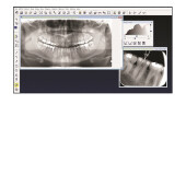 Rentgenový software CliniView