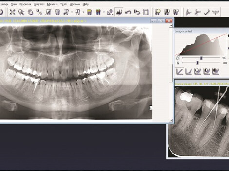 Rentgenový software CliniView